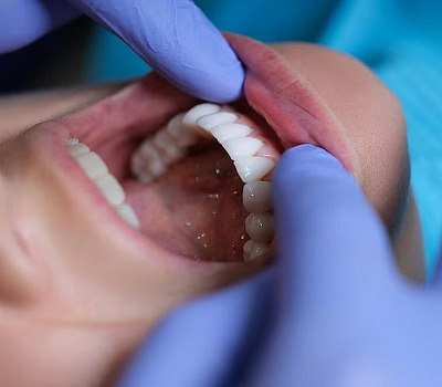 Las mujeres que no se cepillan ni usan hilo dental con frecuencia son más propensas a sufrir migrañas y fibromialgia, según un estudio reciente.  Imagen tomada de Infobae.